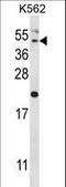 Hepatitis A Virus Cellular Receptor 1 antibody, LS-C166798, Lifespan Biosciences, Western Blot image 