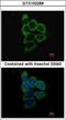 Proteasome 26S Subunit, Non-ATPase 2 antibody, GTX102289, GeneTex, Immunocytochemistry image 