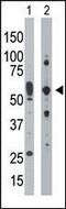 Eukaryotic Translation Initiation Factor 2 Alpha Kinase 2 antibody, PA5-15468, Invitrogen Antibodies, Western Blot image 