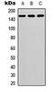 Adhesion G Protein-Coupled Receptor F5 antibody, GTX55241, GeneTex, Western Blot image 