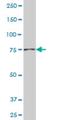 NAD Synthetase 1 antibody, H00055191-M01, Novus Biologicals, Western Blot image 