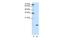 Small Nuclear Ribonucleoprotein D1 Polypeptide antibody, A08352, Boster Biological Technology, Western Blot image 