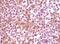 Synuclein Alpha antibody, 32-215, ProSci, Western Blot image 