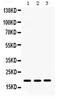 C-X-C Motif Chemokine Ligand 9 antibody, PA5-79116, Invitrogen Antibodies, Western Blot image 