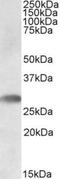 Triggering Receptor Expressed On Myeloid Cells Like 1 antibody, NBP1-45208, Novus Biologicals, Western Blot image 