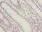 Polo Like Kinase 1 antibody, LS-C397140, Lifespan Biosciences, Immunohistochemistry paraffin image 