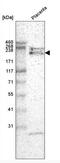 Laminin Subunit Alpha 4 antibody, NBP2-42392, Novus Biologicals, Western Blot image 