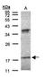 Interferon Alpha 6 antibody, GTX108423, GeneTex, Western Blot image 