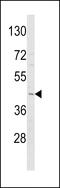 Adiponectin Receptor 1 antibody, MBS9211388, MyBioSource, Western Blot image 