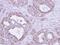 Fumarate Hydratase antibody, NBP1-31336, Novus Biologicals, Immunohistochemistry paraffin image 