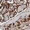 Alpha Kinase 2 antibody, HPA028084, Atlas Antibodies, Immunohistochemistry paraffin image 