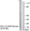 Protein Phosphatase 1 Regulatory Inhibitor Subunit 14A antibody, LS-C117328, Lifespan Biosciences, Western Blot image 