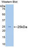 Endothelial Cell Adhesion Molecule antibody, LS-C304492, Lifespan Biosciences, Western Blot image 