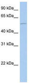 ALG1 Chitobiosyldiphosphodolichol Beta-Mannosyltransferase antibody, TA331088, Origene, Western Blot image 