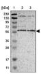 EF-Hand Calcium Binding Domain 14 antibody, NBP1-86104, Novus Biologicals, Western Blot image 