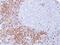 CD8 antibody, MA5-16345, Invitrogen Antibodies, Immunohistochemistry frozen image 