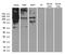 RB Transcriptional Corepressor 1 antibody, LS-C793917, Lifespan Biosciences, Western Blot image 