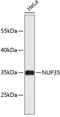 Nucleoporin 35 antibody, 23-852, ProSci, Western Blot image 