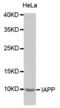 Islet Amyloid Polypeptide antibody, abx002102, Abbexa, Western Blot image 