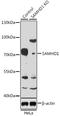 SAM And HD Domain Containing Deoxynucleoside Triphosphate Triphosphohydrolase 1 antibody, A00592-2, Boster Biological Technology, Western Blot image 