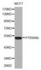 Ribosomal Protein S6 Kinase B2 antibody, abx001298, Abbexa, Western Blot image 