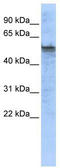 Tryptophan Hydroxylase 2 antibody, TA334765, Origene, Western Blot image 