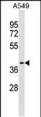 Zinc Finger CCHC-Type Containing 12 antibody, PA5-48897, Invitrogen Antibodies, Western Blot image 