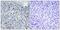 DNA Topoisomerase II Alpha antibody, PA5-40159, Invitrogen Antibodies, Immunohistochemistry frozen image 