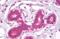 CD44 antibody, orb375226, Biorbyt, Immunohistochemistry paraffin image 
