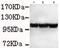 Hexokinase 2 antibody, ab131196, Abcam, Western Blot image 