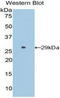 Surfactant Protein B antibody, LS-C296551, Lifespan Biosciences, Western Blot image 