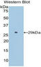 PSPB antibody, LS-C296551, Lifespan Biosciences, Western Blot image 