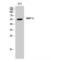 Matrix Metallopeptidase 8 antibody, LS-C384585, Lifespan Biosciences, Western Blot image 