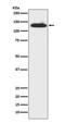 c-Kit antibody, M01335-1, Boster Biological Technology, Western Blot image 