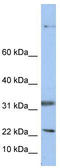 Selenoprotein F antibody, TA346587, Origene, Western Blot image 