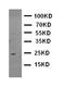 Growth Factor Receptor Bound Protein 2 antibody, LS-C312731, Lifespan Biosciences, Western Blot image 