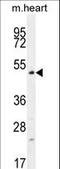 TSPY Like 4 antibody, LS-C160275, Lifespan Biosciences, Western Blot image 