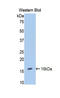Endoglin antibody, LS-C304065, Lifespan Biosciences, Western Blot image 