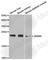 Matrix Metallopeptidase 8 antibody, A1963, ABclonal Technology, Western Blot image 