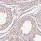 RB1 Inducible Coiled-Coil 1 antibody, HPA053049, Atlas Antibodies, Immunohistochemistry frozen image 