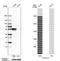 Aldehyde Dehydrogenase 1 Family Member A1 antibody, NBP1-89152, Novus Biologicals, Western Blot image 