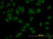 SET Domain Containing 7, Histone Lysine Methyltransferase antibody, LS-B8443, Lifespan Biosciences, Immunofluorescence image 