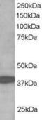 Ring Finger Protein 39 antibody, PA5-18128, Invitrogen Antibodies, Western Blot image 