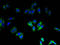 NADPH Oxidase 4 antibody, A63034-100, Epigentek, Immunofluorescence image 
