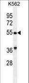 Growth Differentiation Factor 9 antibody, LS-C166430, Lifespan Biosciences, Western Blot image 