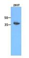 Cytosolic acyl coenzyme A thioester hydrolase antibody, GTX53682, GeneTex, Western Blot image 