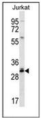 CTD Nuclear Envelope Phosphatase 1 antibody, AP51335PU-N, Origene, Western Blot image 