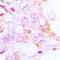 Ribosomal Protein S6 Kinase B1 antibody, LS-C368519, Lifespan Biosciences, Immunohistochemistry paraffin image 