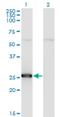 Thymidine Kinase 1 antibody, H00007083-M04, Novus Biologicals, Western Blot image 