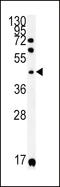 Killer Cell Immunoglobulin Like Receptor, Two Ig Domains And Short Cytoplasmic Tail 2 antibody, LS-C165531, Lifespan Biosciences, Western Blot image 